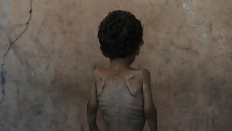 Netanyahu'nun Gazze Açıklamaları: Gerçekler ve Çelişkili Rakamlar