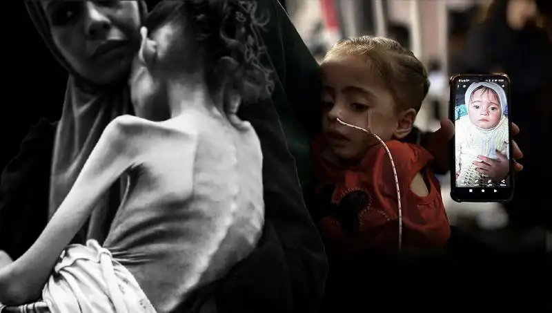 25 Kilodan 10 Kiloya Düşen Küçük Meryem'in Zorlu Mücadelesi