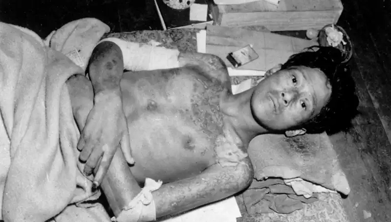 80 Yıl Sonra Nagasaki’den Gelen Çarpıcı Uyarı: Nükleer Felaket Tehlikesi!